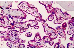 Immunohistochemistry (Formalin-fixed Paraffin-embedded Sections) (IHC (fp)) image for anti-Sterol Regulatory Element Binding Transcription Factor 2 (SREBF2) (AA 434-483) antibody (ABIN6736431)