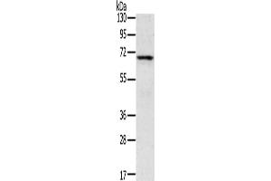 Gel: 8 % SDS-PAGE, Lysate: 40 μg, Lane: Human fetal brain tissue, Primary antibody: ABIN7192841(TNK1 Antibody) at dilution 1/400, Secondary antibody: Goat anti rabbit IgG at 1/8000 dilution, Exposure time: 5 minutes (TNK1 抗体)