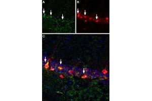 Bungarotoxin binding sites co-localize with GABAergic neurons expressing parvalbumin in mouse hippocampal CA1 region. (alpha-Bungarotoxin protein (Biotin))