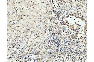 IHC analysis of EDC4 using anti-EDC4 antibody (ABIN7599694).