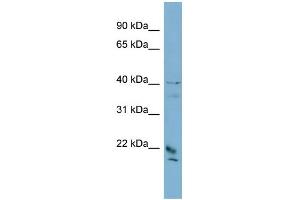 WB Suggested Anti-DYDC1 Antibody Titration: 0. (DYDC1 抗体  (Middle Region))