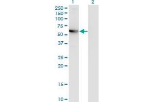 Western Blot analysis of CCDC83 expression in transfected 293T cell line by MGC34732 monoclonal antibody (M01), clone 3E3. (CCDC83 抗体  (AA 341-444))