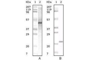 Western blot analysis using Apoa5 mouse mAb against human serum (A) and Apoa5 recombinant protein (B). (APOA5 抗体)