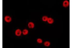 ABIN6277194 staining HepG2 by IF/ICC.