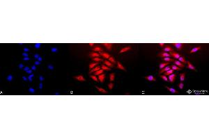 Immunocytochemistry/Immunofluorescence analysis using Rabbit Anti-SOD (Cu/Zn) Polyclonal Antibody . (SOD1 抗体  (HRP))