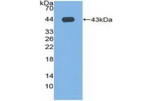 Detection of Recombinant PLD, Human using Polyclonal Antibody to Phospholipase D (PLD) (Phospholipase D 抗体  (AA 725-1074))