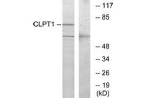 Western Blotting (WB) image for anti-Cleft Lip and Palate Associated Transmembrane Protein 1 (CLPTM1) (AA 200-249) antibody (ABIN2890759) (CLPTM1 抗体  (AA 200-249))