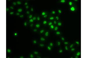 Immunofluorescence analysis of U20S cell using HIRIP3 antibody. (HIRIP3 抗体)