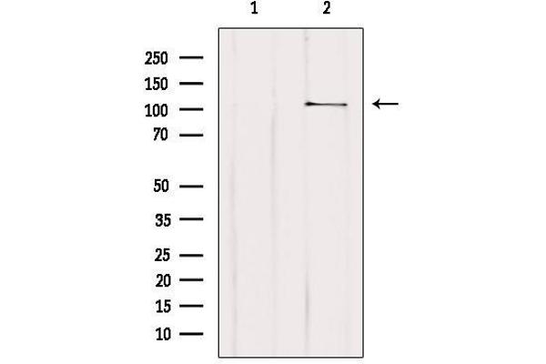 MTHFD1L 抗体  (C-Term)