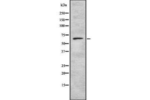 Western blot analysis of Collagen VIII α2 using LOVO whole cell lysates (COL8a2 抗体  (Internal Region))