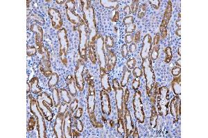 IHC analysis of KMO using anti-KMO antibody (ABIN7600958).