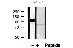 Western blot analysis of extracts of HeLa and ND7 cells, using CAPRIN1 antibody. (Caprin-1 抗体  (Internal Region))