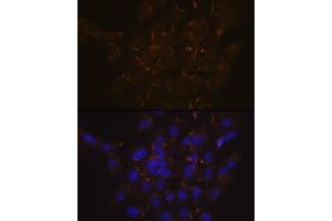 Immunofluorescence analysis of C6 cells using Phospholipid Phospholipid Scramblase 1 (PLSCR1) (PLSCR1) Rabbit mAb (ABIN7269354) at dilution of 1:100 (40x lens). (PLSCR1 抗体)