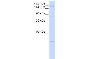 WB Suggested Anti-ZNF687 Antibody Titration:  0. (ZNF687 抗体  (C-Term))