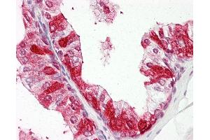 Anti-ZNF385A / ZNF385 antibody IHC of human prostate. (ZNF385A 抗体  (N-Term))