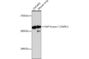 Western blot analysis of extracts of various cell lines, using DAP Kinase 1 (D) Rabbit mAb (ABIN7266711) at 1:1000 dilution. (DAP Kinase 1 抗体)