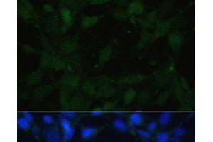 Immunofluorescence analysis of NIH/3T3 cells using TRPV1 Polyclonal Antibody at dilution of 1:100. (TRPV1 抗体)