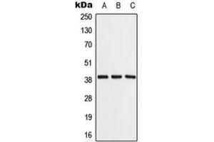 Western blot analysis of ALDOB expression in Raji (A), NIH3T3 (B), rat liver (C) whole cell lysates. (ALDOB 抗体  (Center))