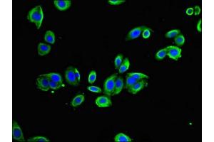 Immunofluorescent analysis of HepG2 cells using ABIN7172377 at dilution of 1:100 and Alexa Fluor 488-congugated AffiniPure Goat Anti-Rabbit IgG(H+L) (TRAPPC9 抗体  (AA 780-1030))
