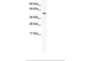 Image no. 1 for anti-Elongator Acetyltransferase Complex Subunit 4 (ELP4) (AA 230-279) antibody (ABIN202485) (ELP4 抗体  (AA 230-279))