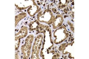 Immunohistochemistry of paraffin-embedded human kidney using GPS1 antibody at dilution of 1:100 (x400 lens). (GPS1 抗体)