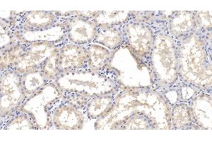 Detection of IL18R1 in Human Kidney Tissue using Monoclonal Antibody to Interleukin 18 Receptor 1 (IL18R1) (IL18R1 抗体  (AA 375-428))