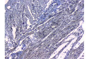 IHC analysis of MAX using anti-MAX antibody . (MAX 抗体  (AA 30-106))