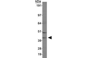 Western blot of ABHD5 in MCF-7 cell lysates using ABHD5 polyclonal antibody . (ABHD5 抗体  (AA 200-300))