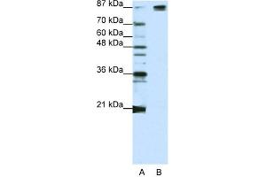 WB Suggested Anti-SF3B1 Antibody Titration:  1. (SF3B1 抗体  (Middle Region))