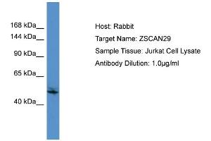Host:  Rabbit  Target Name:  ZSCAN29  Sample Type:  Jurkat Whole Cell lysates  Antibody Dilution:  1. (ZSCAN29 抗体  (C-Term))