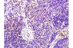 Paraformaldehyde-fixed, paraffin embedded rat spleen tissue, Antigen retrieval by boiling in sodium citrate buffer(pH6) for 15min, Block endogenous peroxidase by 3% hydrogen peroxide for 30 minutes, Blocking buffer (normal goat serum) at 37°C for 20min, Antibody incubation with Rabbit Anti-LAT (Tyr161) Polyclonal Antibody, Unconjugated  at 1:400 overnight at 4°C, followed by a conjugated secondary and DAB staining (LAT 抗体  (pTyr161))
