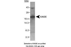 Image no. 1 for anti-X Antigen Family, Member 1D (XAGE1D) antibody (ABIN363336) (XAGE1D 抗体)
