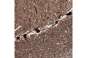 Immunohistochemical staining of human cerebellum with C18orf32 polyclonal antibody  shows strong cytoplasmic and nuclear positivity in purkinje cells at 1:20-1:50 dilution. (C18orf32 抗体)