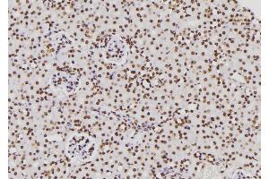 ABIN6276831 at 1/100 staining Rat kidney tissue by IHC-P. (CTBP1 抗体  (Internal Region))