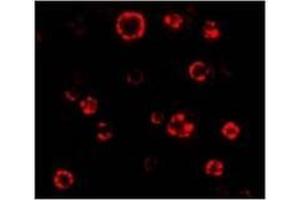 AP20063PU-N ATG16 antibody staining of HeLa Cell Lysate by Immunofluorescence at 4.