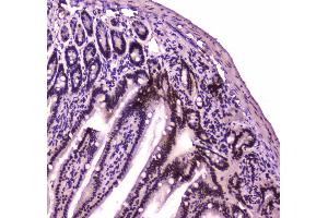 Immunohistochemistry (IHC) image for anti-SWI/SNF Related, Matrix Associated, Actin Dependent Regulator of Chromatin, Subfamily A, Member 4 (SMARCA4) (AA 555-763) antibody (ABIN5692863)