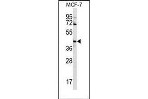 Western blot analysis of GNA14 Antibody (N-term) in MCF-7 cell line lysates (35ug/lane). (GNa14 抗体  (N-Term))
