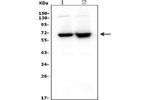 Western blot analysis of CD5 using anti-CD5 antibody (ABIN7600913).
