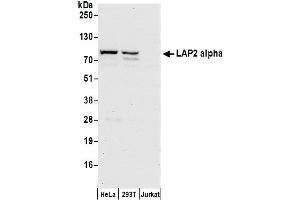Western Blotting (WB) image for anti-Thymopoietin (TMPO) (AA 200-250) antibody (ABIN7453438)
