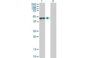 Western Blot analysis of CALR expression in transfected 293T cell line by CALR monoclonal antibody (M01), clone 1G11-1A9. (Calreticulin 抗体  (AA 1-417))