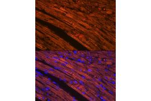 Immunofluorescence analysis of rat heart using Cardiac Cardiac troponin T (TNNT2) (TNNT2) Rabbit mAb (ABIN7266088) at dilution of 1:100 (40x lens).