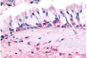 OR10J5 抗体  (Extracellular Domain)