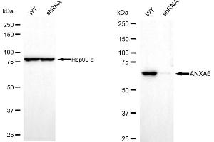 Western blotting analysis using annexin A6 antibody (ABIN7797623). (Recombinant ANXA6 抗体)