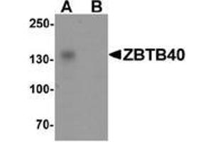 Western blot analysis of ZBTB40 in Raji cell lysate with ZBTB40 Antibody  at 0. (ZBTB40 抗体  (N-Term))