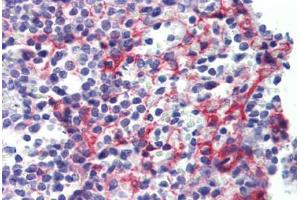 Human Spleen (formalin-fixed, paraffin-embedded) stained with PDGFRB antibody ABIN462353 followed by biotinylated anti-mouse IgG secondary antibody ABIN481714, alkaline phosphatase-streptavidin and chromogen. (PDGFRB 抗体)
