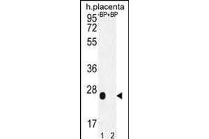 Western blot analysis of OR2J3 Antibody Pab pre-incubated without(lane 1) and with(lane 2) blocking peptide in human placenta tissue lysate. (OR2J3 抗体  (C-Term))