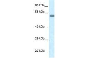 Image no. 1 for anti-FERM Domain Containing 5 (FRMD5) (AA 75-124) antibody (ABIN6747667) (FRMD5 抗体  (AA 75-124))