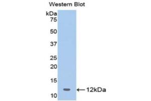 Western Blotting (WB) image for anti-2',5'-Oligoadenylate Synthetase 1, 40/46kDa (OAS1) (AA 74-165) antibody (ABIN1175790) (OAS1 抗体  (AA 74-165))