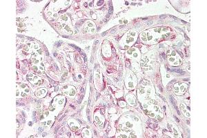 Anti-RARRES3 antibody IHC of human placenta.