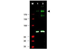 Western blot using IRS1 (phospho S307) polyclonal antibody  shows detection of a band at ~180 KDa believed to represent phosphorylated IRS1 (arrowhead). (IRS1 抗体  (pSer307))